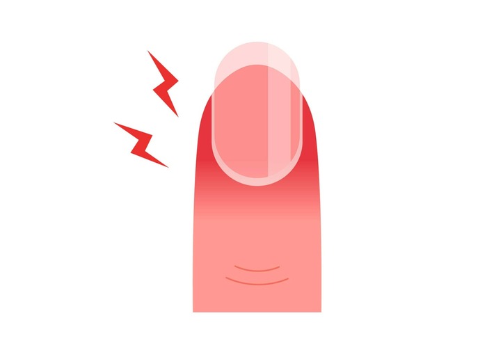 7 causes possibles de la douleur sous d’ongle du doigt