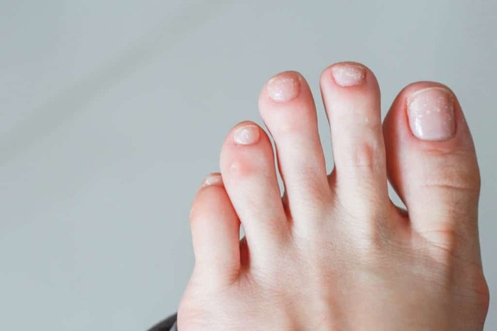 Enlever Tache Blanche Sur Bois Vernis